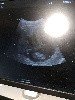  - Confirmation de gestation de Nyméria